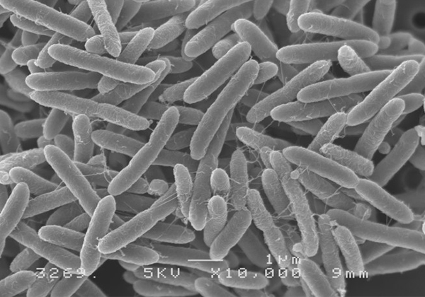 ブレビバチルス菌の電子顕微鏡写真
